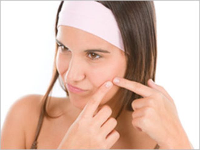 como quitar el acne